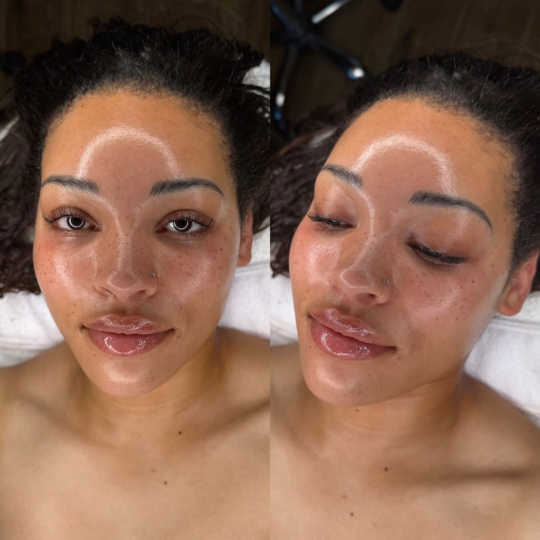 Kedirose signature HydraFacial treatment result Kempton Park